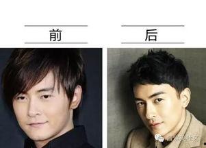 男网红整容脸吃瓜图片,吃瓜群众热议男网红变脸之谜